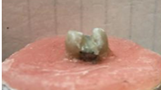 Opaque had applied to amalgam on occlusal surface