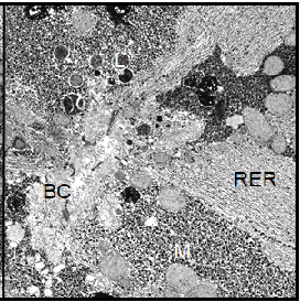 (Right) The morphology of hepatocytes taken from a Xenopus control female. The cells contain a larger amount of cell organelles involved in protein synthesis as compared to the male hepatocytes. Magnification:  4700.