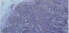 General view of lymph-nodes showing structural modifications