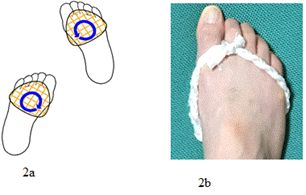 Figure 2 Walking and running of the foot associated with Ashinaka