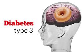 Type 3 Diabetes and Alzheimer’s Disease